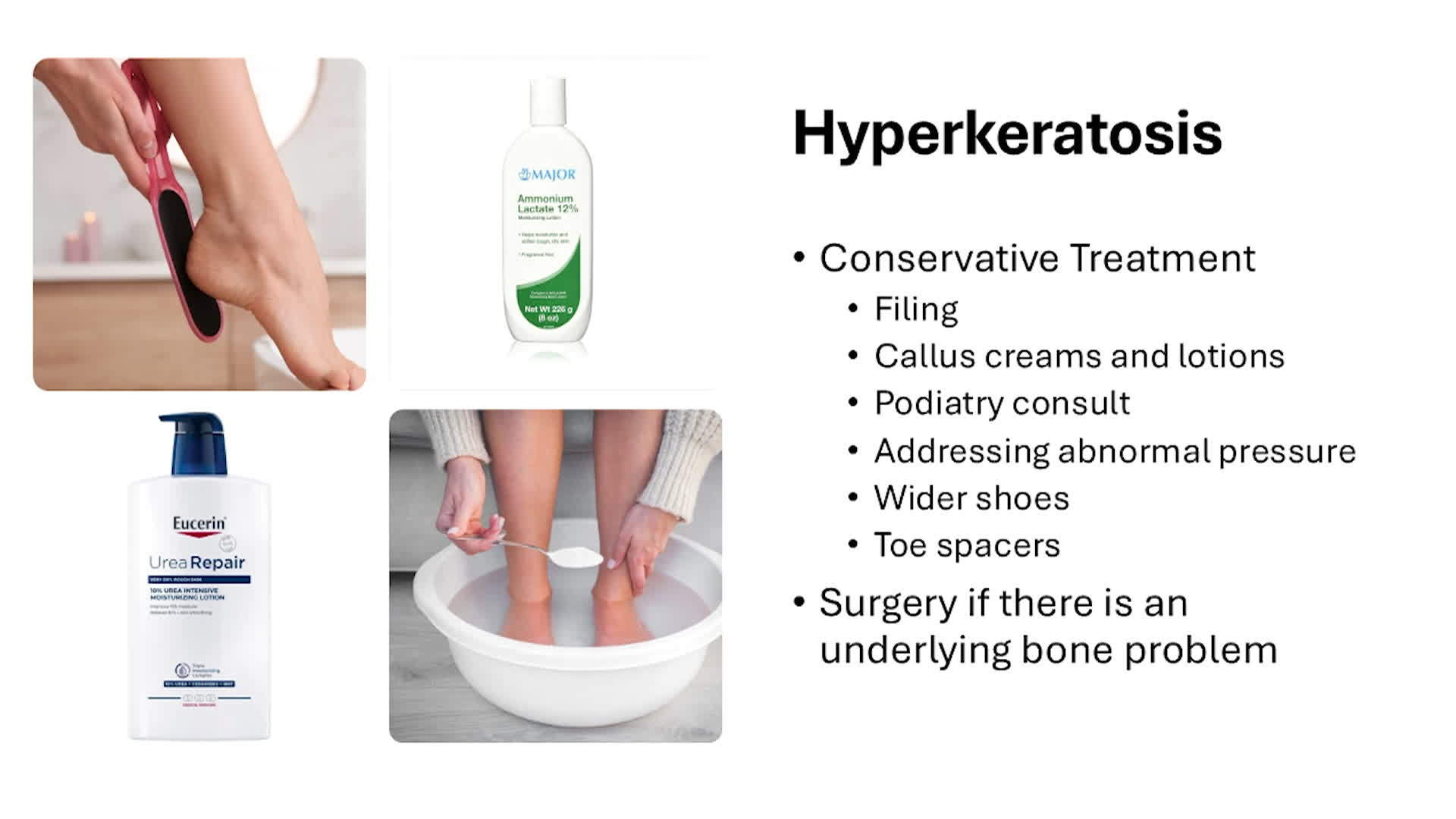 Keep Your Feet Healthy